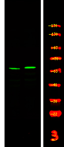 CSK (Phospho-Tyr304)
