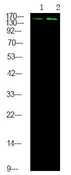 DAPK1 (Phospho-Ser289)