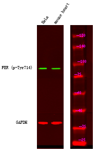 FER (Phospho-Tyr714)