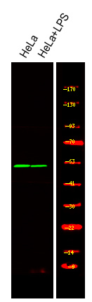 MST3 (Phospho-Thr18)