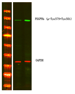 PDGFRb (Phospho-Tyr579+Tyr581)