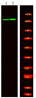 TIE1 (Phospho-Tyr1117)