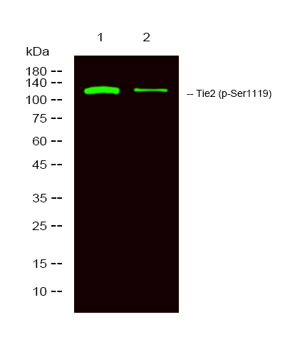 TIE2 (Phospho-Ser1119)