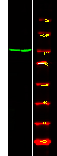 Androgen Receptor (Phospho-Ser81)