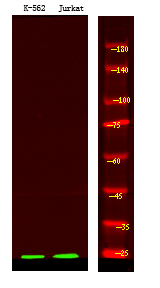 BCL-1(Phospho-Ser138)