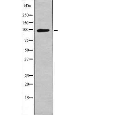 Leptin Receptor (Phospho-Tyr1141)