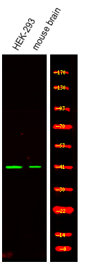 Ataxin-3 (Phospho-Ser256)