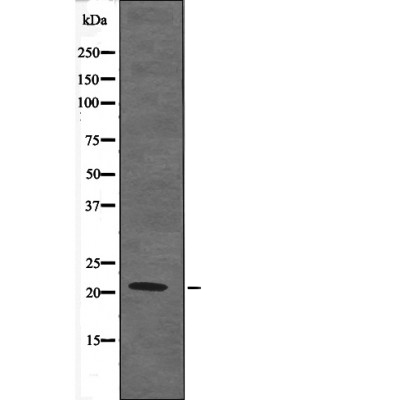 Claudin 4 (Phospho-Tyr208)