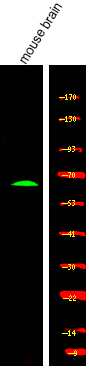 CRMP-1 (Phospho-Tyr504)