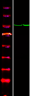 CTNND1 (Phospho-Tyr257)