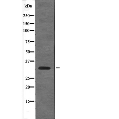 Cyclin D1 (Phospho-Thr288)