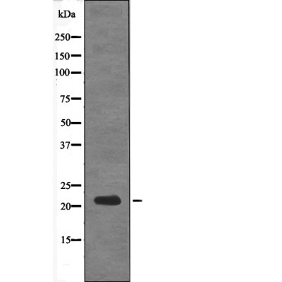 DSCR1 (Phospho-Ser108)