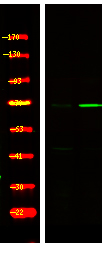 FKHRL1 (Phospho-Ser321)