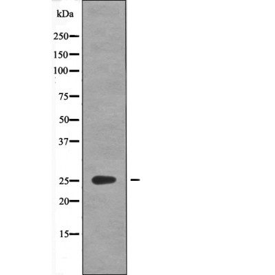 GAIP (Phospho-Ser151)