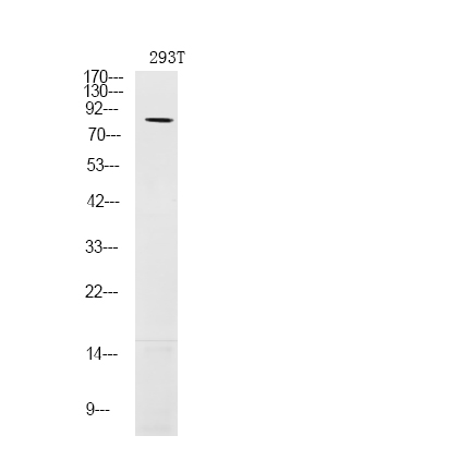 LIMK1 (Phospho-Ser310)
