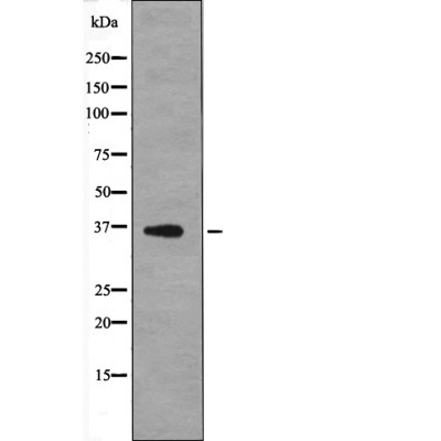 MCL1 (Phospho-Thr163)