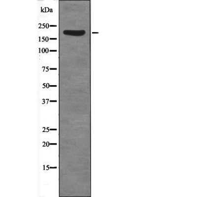 SRC-1 (Phospho-Thr1179)