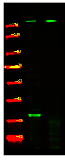 Tuberin (Phospho-Ser981)