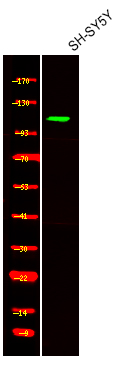 Ack1 (Phospho-Tyr857+Tyr858)