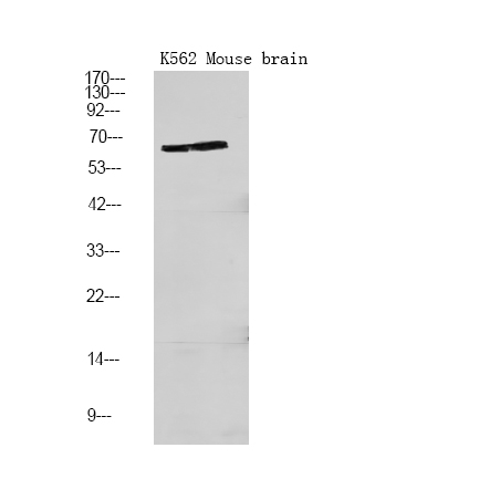 PFKFB2 (Phospho-Ser466)