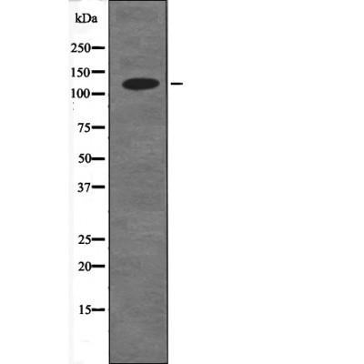 CDH1 (Phospho-Ser844)
