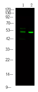 p56 Dok-2 (Phospho-Tyr139)