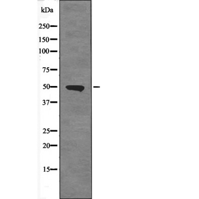 ETS1 (Phospho-Ser251)