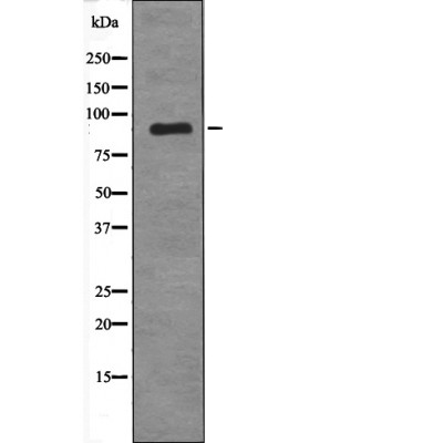 MDM2 (Phospho-Tyr394)