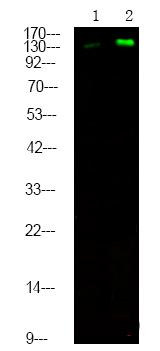 MET (Phospho-Tyr1365)