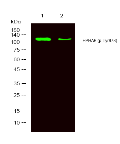 EPHA6 (Phospho-Tyr977)