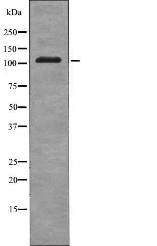 EPHB3 (Phospho-Tyr608)