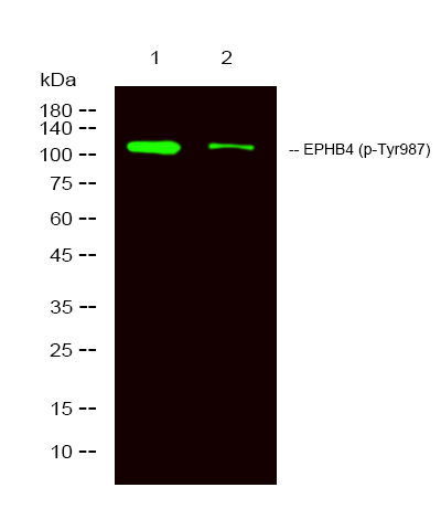 EPHB4 (Phospho-Tyr987)