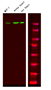 HER4 (Phospho-Tyr1242)