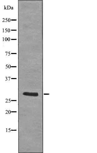 LAT (Phospho-Tyr255)