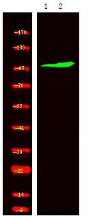 ROR2 (Phospho-Ser449)