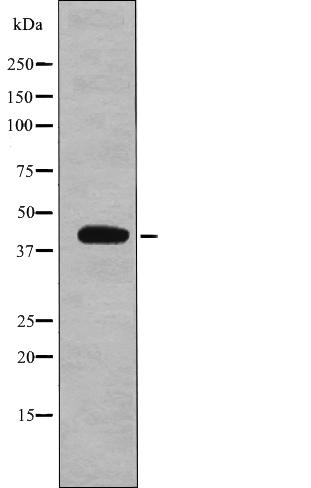 eIF2B (Phospho-Ser67)