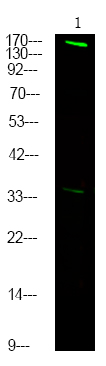 FANCD2 (Phospho-Thr691)