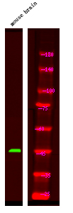 GFAP (Phospho-Ser13)