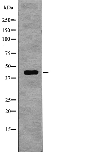 NDRG1 (Phospho-Thr346)