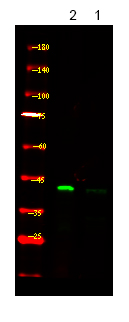 PDHA1/2 (Phospho-Ser293/291)