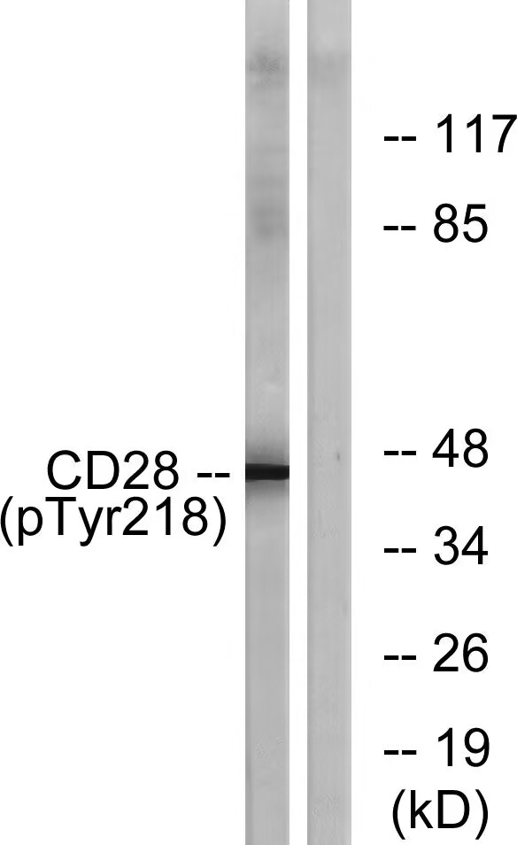 CD28 (Phospho-Tyr218)