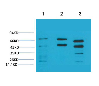 Phosphoserine(5B12)