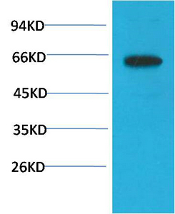 Phospho-Akt (S473) Mouse(6F8)