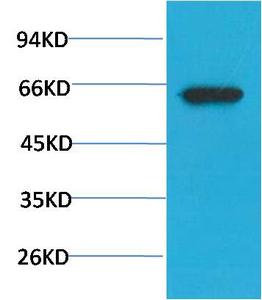 Phospho-Akt (S473) Mouse(7F9)