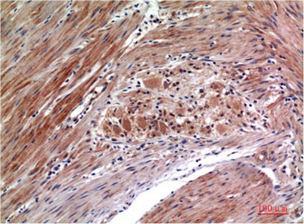 Mouse Monoclonal Antibody to Phospho-ERK 1/2 (Y222/205)