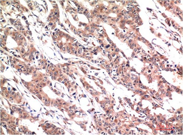 Phospho-Stat3 (Y705) Mouse(1E9)