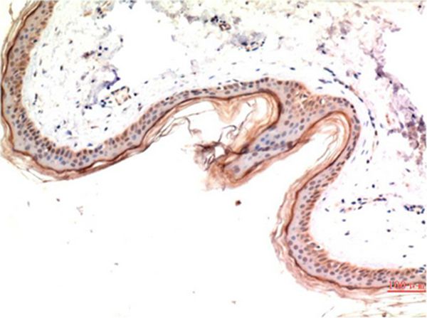 phospho-MLKL (S358) Mouse(6F8)