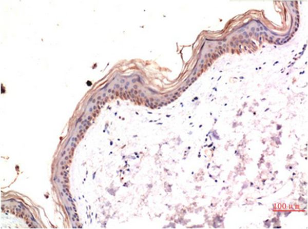 phospho-MLKL (S358) Mouse(6B4)