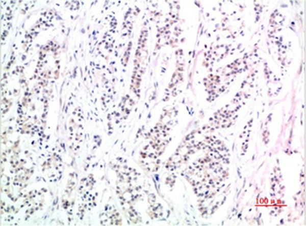 Phospho-Smad3(S425) Mouse(1D9)