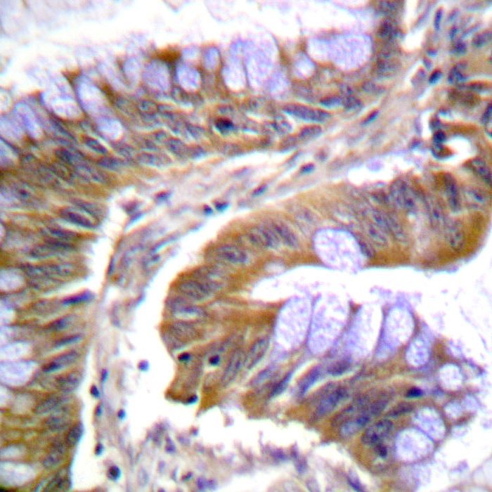 Rabbit Polyclonal Antibody to IRAK1 (phospho-Thr100)